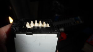 Geared teeth